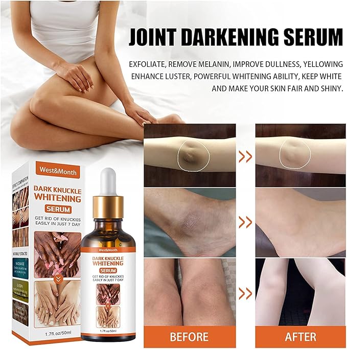 Dark Knuckles Whitening Serum